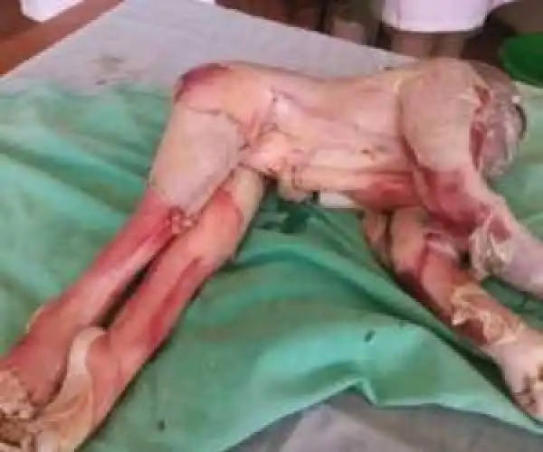 Graphic Photos: Zimbabwean Woman Gives Birth To A Strange Looking Baby 